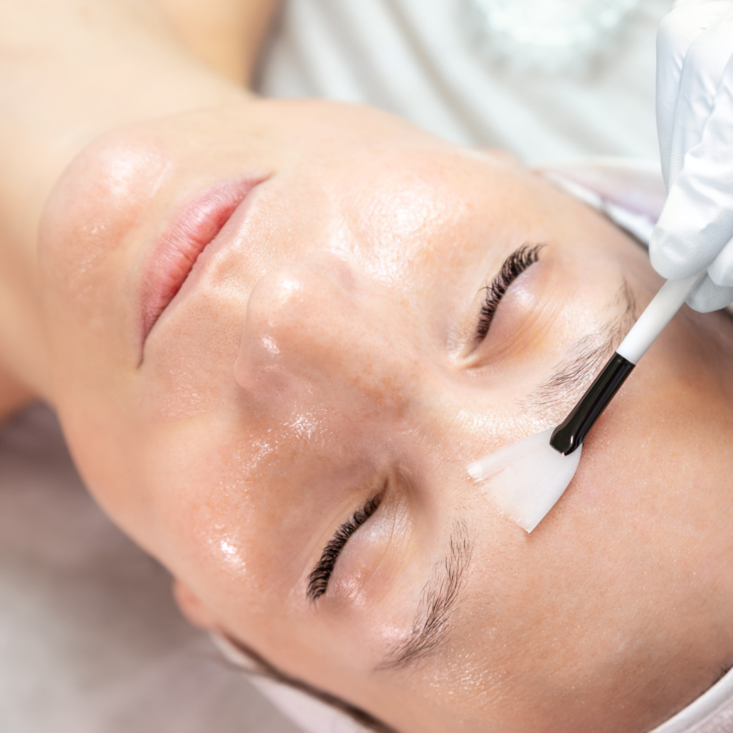 Fruchtsäurepeeling: Fruchtsäure wird mit einem Pinsel auf das Gesicht aufgetragen