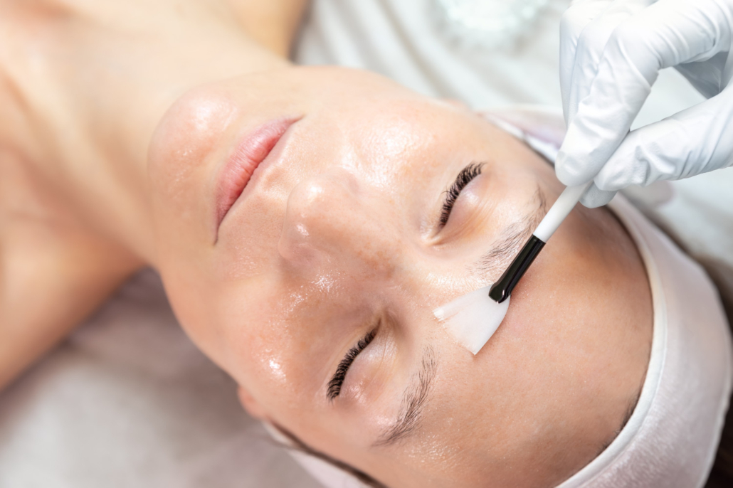 Fruchtsäurepeeling: Fruchtsäure wird mit einem Pinsel auf das Gesicht aufgetragen