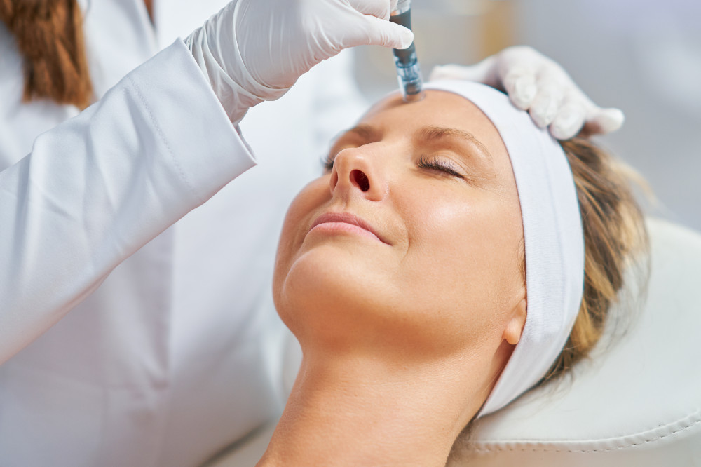 Microneedling: Behandlung der Stirn mit dem Microneedling-Pen