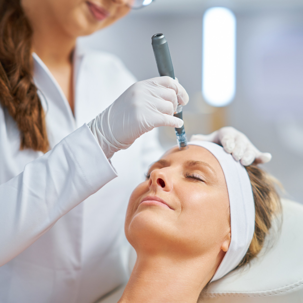 Microneedling: Behandlung der Stirn mit dem Microneedling-Pen